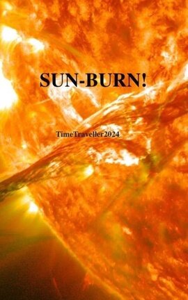 SUN-BURN!