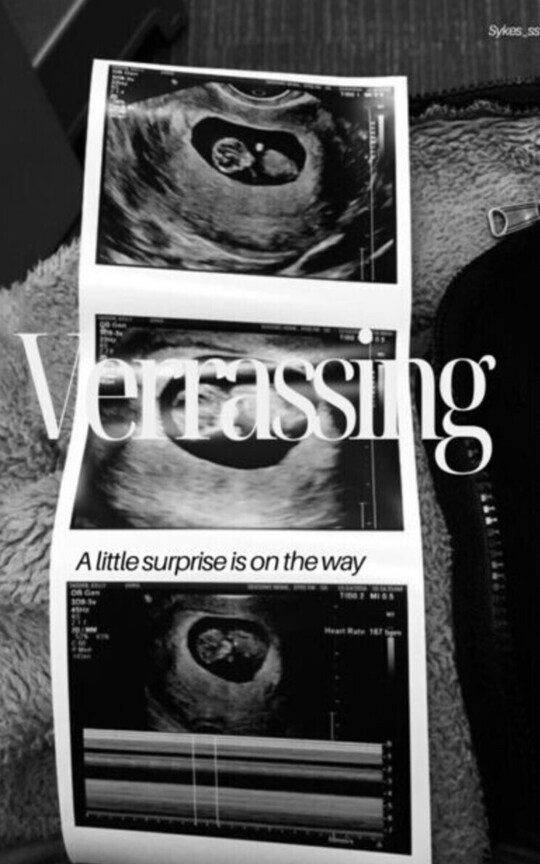 Verrasing