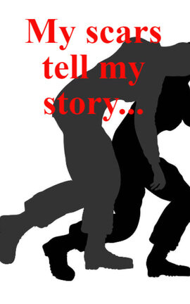 My scars tell my story...